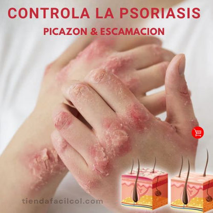 SPRAY ALIVIO PSORIASIS