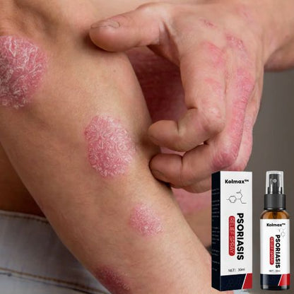 SPRAY ALIVIO PSORIASIS