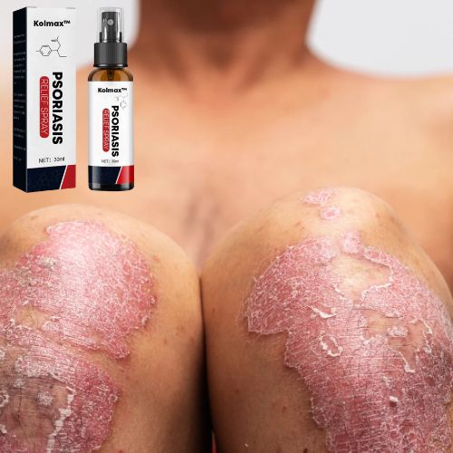 SPRAY ALIVIO PSORIASIS